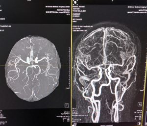 سی تی اسکن مغز در مرکز تصویربرداری پزشکی میرعماد قزوین